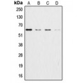 LifeSab™ AKT Rabbit pAb (50 µl)