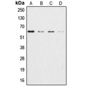 LifeSab™ AKT Rabbit pAb (50 µl)