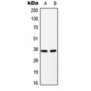 LifeSab™ C/EBP alpha (pS193) Rabbit pAb (50 µl)