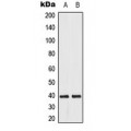 LifeSab™ DUSP1/4 Rabbit pAb (50 µl)