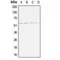 LifeSab™ ACVR1B Rabbit pAb (50 µl)