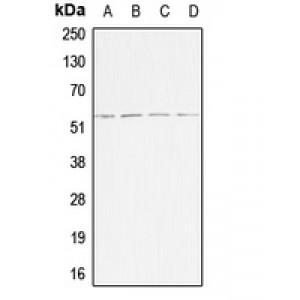 LifeSab™ ACVR1B Rabbit pAb (50 µl)