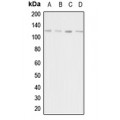 LifeSab™ Adenylate Cyclase 1 Rabbit pAb (50 µl)