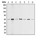 LifeSab™ AKT Rabbit pAb (50 µl)