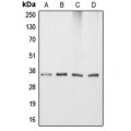 LifeSab™ Apolipoprotein E Rabbit pAb (50 µl)