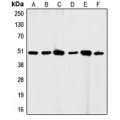 LifeSab™ CD95 Rabbit pAb (50 µl)