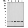LifeSab™ Aquaporin 5 Rabbit pAb (50 µl)