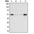 LifeSab™ Beta-arrestin-1 (pS412) Rabbit pAb (50 µl)