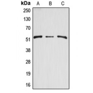LifeSab™ Arylsulfatase A Rabbit pAb (50 µl)