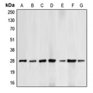 LifeSab™ BCL2 (pT69) Rabbit pAb (50 µl)