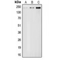 LifeSab™ BRCA1 Rabbit pAb (50 µl)