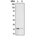LifeSab™ Probetacellulin Rabbit pAb (50 µl)