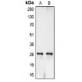 LifeSab™ Carbonic Anhydrase 1 Rabbit pAb (50 µl)