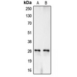 LifeSab™ Carbonic Anhydrase 1 Rabbit pAb (50 µl)
