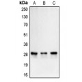 LifeSab™ Carbonic Anhydrase 2 Rabbit pAb (50 µl)