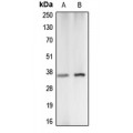 LifeSab™ Carbonic Anhydrase 5A Rabbit pAb (50 µl)