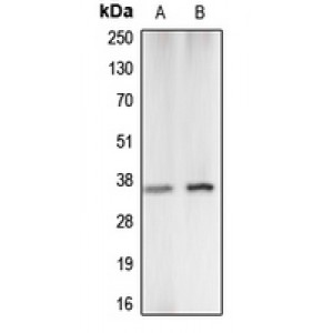 LifeSab™ Carbonic Anhydrase 5A Rabbit pAb (50 µl)