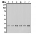 LifeSab™ Caveolin 1 Rabbit pAb (50 µl)
