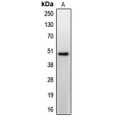 LifeSab™ CCKBR Rabbit pAb (50 µl)