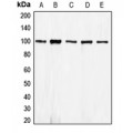 LifeSab™ E Cadherin Rabbit pAb (50 µl)