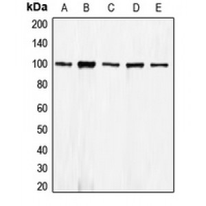 LifeSab™ E Cadherin Rabbit pAb (50 µl)
