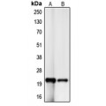 LifeSab™ p21 Rabbit pAb (50 µl)