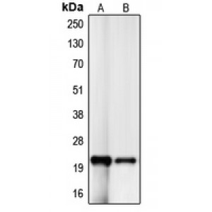 LifeSab™ p21 Rabbit pAb (50 µl)