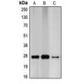 LifeSab™ p27 Kip1 Rabbit pAb (50 µl)