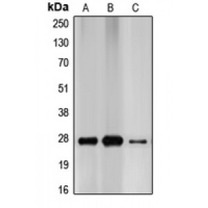 LifeSab™ p27 Kip1 Rabbit pAb (50 µl)