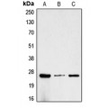 LifeSab™ CG beta Rabbit pAb (50 µl)