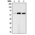 LifeSab™ CHK1 (pS317) Rabbit pAb (50 µl)