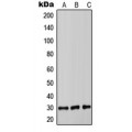 LifeSab™ COMT Rabbit pAb (50 µl)