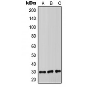 LifeSab™ COMT Rabbit pAb (50 µl)