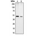 LifeSab™ Carboxypeptidase A1 Rabbit pAb (50 µl)