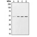 LifeSab™ CK1 gamma 2 Rabbit pAb (50 µl)