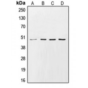 LifeSab™ CK1 gamma 2 Rabbit pAb (50 µl)