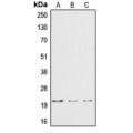 LifeSab™ Cardiotrophin-1 Rabbit pAb (50 µl)