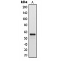 LifeSab™ Cytochrome P450 2A7 Rabbit pAb (50 µl)