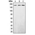 LifeSab™ EGFR Rabbit pAb (50 µl)