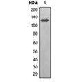 LifeSab™ EPHB6 Rabbit pAb (50 µl)