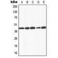 LifeSab™ Galactose Kinase Rabbit pAb (50 µl)