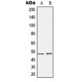 LifeSab™ GHRH Receptor Rabbit pAb (50 µl)