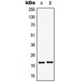 LifeSab™ GSC2 Rabbit pAb (50 µl)