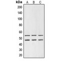 LifeSab™ GSK3 alpha/beta Rabbit pAb (50 µl)
