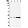 LifeSab™ HOXD8 Rabbit pAb (50 µl)