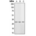 LifeSab™ HSD11B1 Rabbit pAb (50 µl)