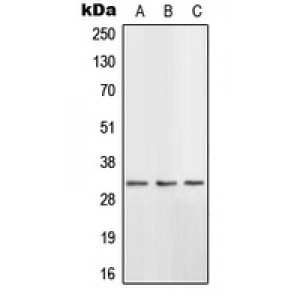 LifeSab™ HSD11B1 Rabbit pAb (50 µl)