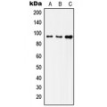 LifeSab™ Insulin Receptor Rabbit pAb (50 µl)