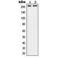 LifeSab™ CD104 Rabbit pAb (50 µl)