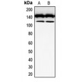 LifeSab™ CD117 Rabbit pAb (50 µl)